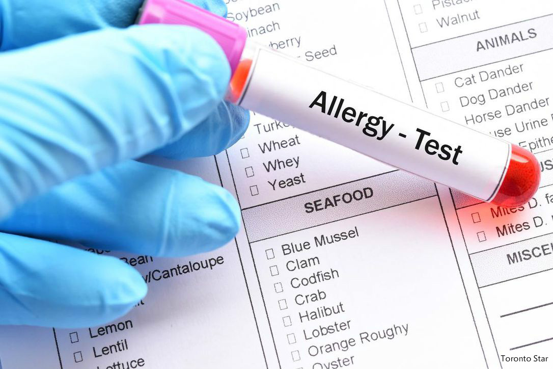 Think you have a food allergy You might be wrong